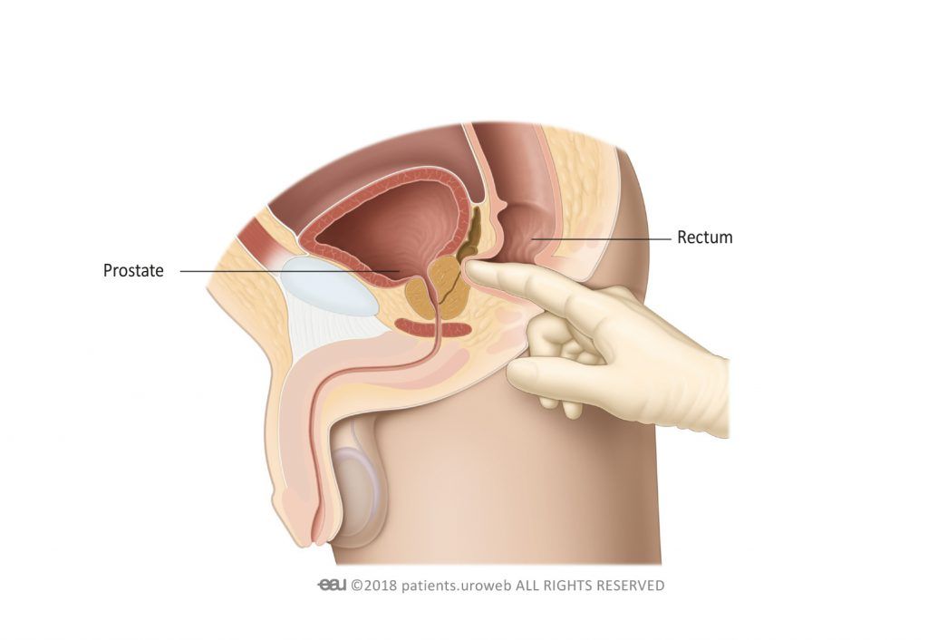 Diagnosis of urinary incontinence